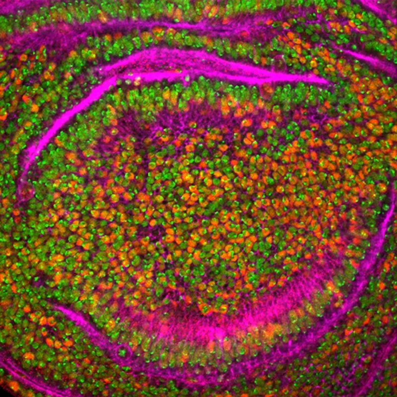 wp3-identification-and-profiling-of-malignant-migratory-cells-the